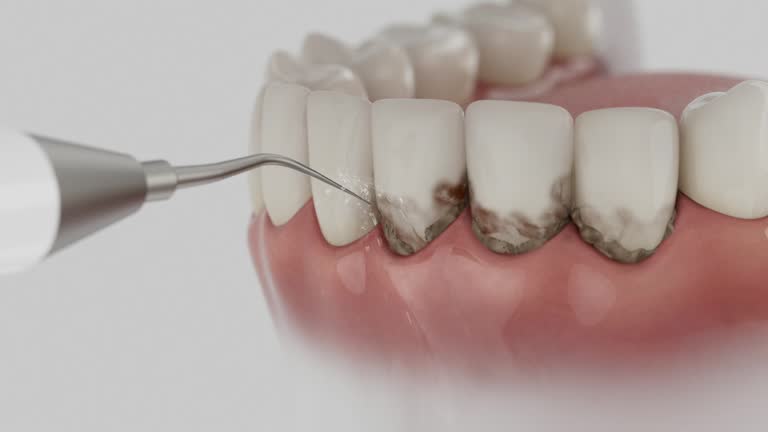 Trusted Tooth Extraction service in Tahlequah, OK - Dentist Open Now